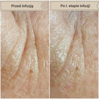 Gabinet Kosmetologii Profesjonalnej Subtelnia